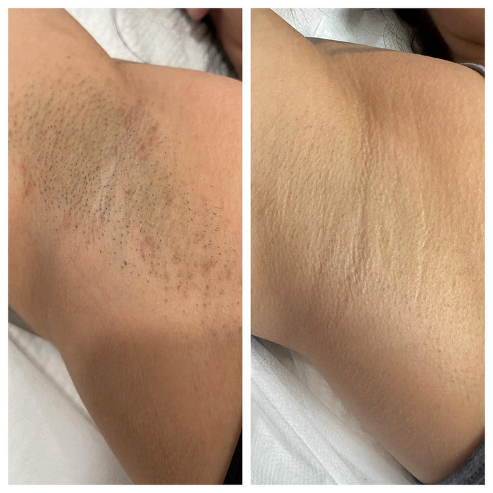 Before and after result — Amelia