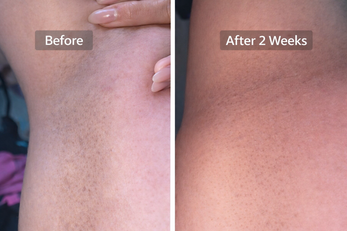 Before and After
