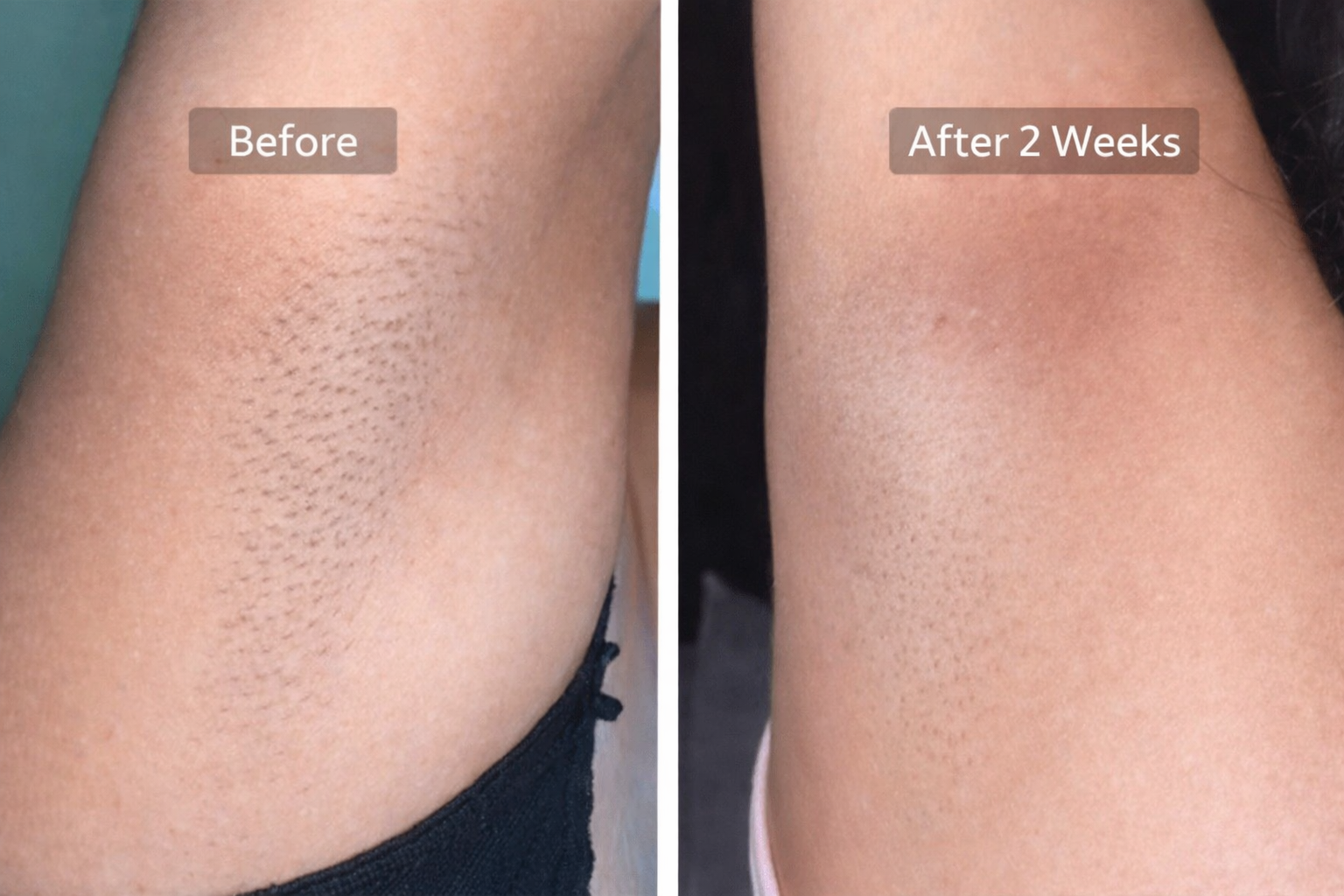 slider image slider_item_XL3YPM