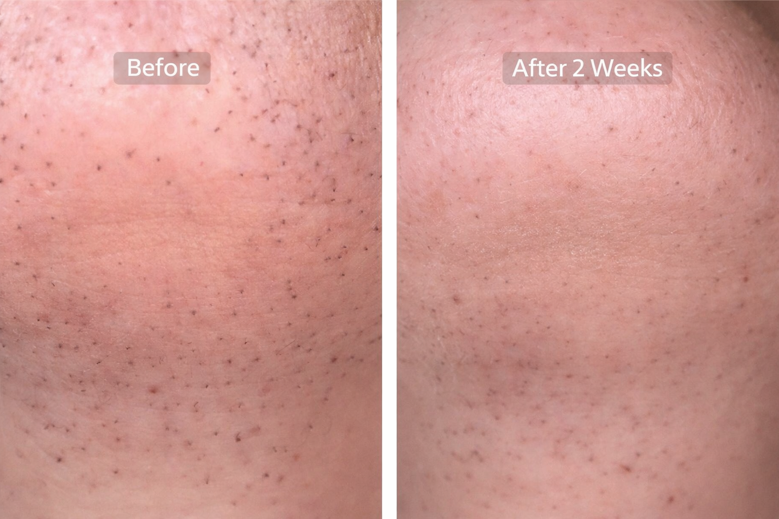 slider image slider_item_JNpWpt