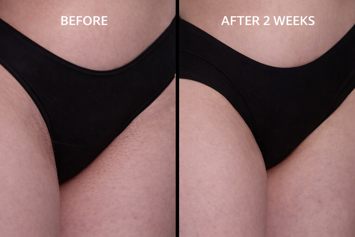 Before and After